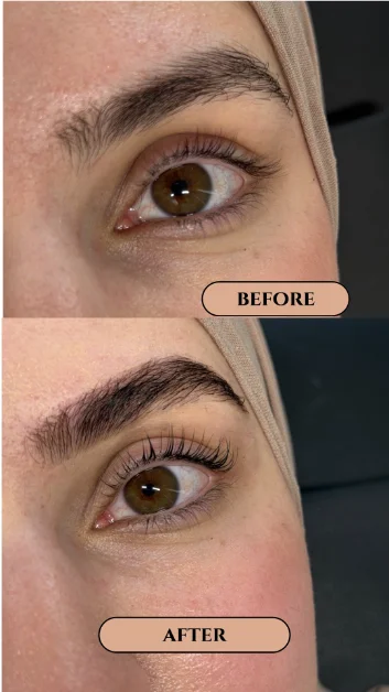 Resultaat behandeling Ayu Beauty Studio