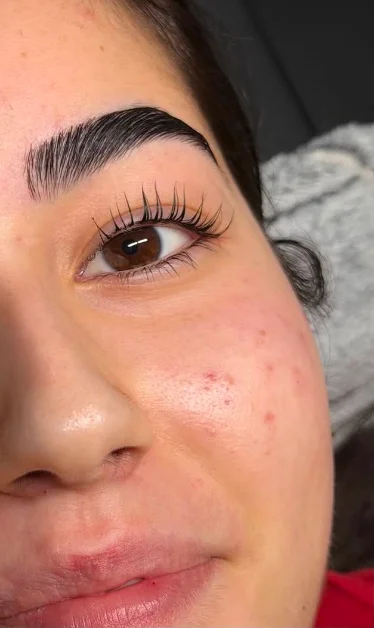 Resultaat behandeling Ayu Beauty Studio